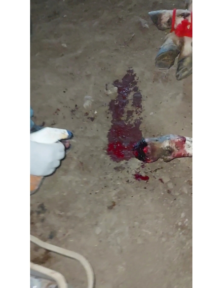 Gaumata Spine Injury, Shoulder Dislocated – Mayur Vihar Phase 2 Delhi