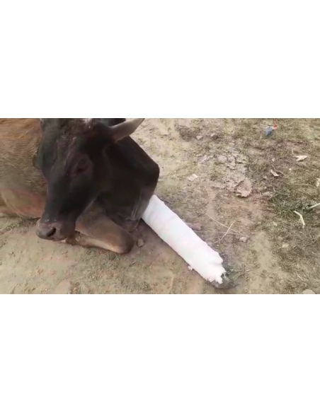 Gaumata baby fractured leg , greater noida