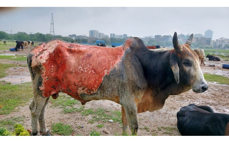 Mahadev Nandi, Third-Degree Burns –...
